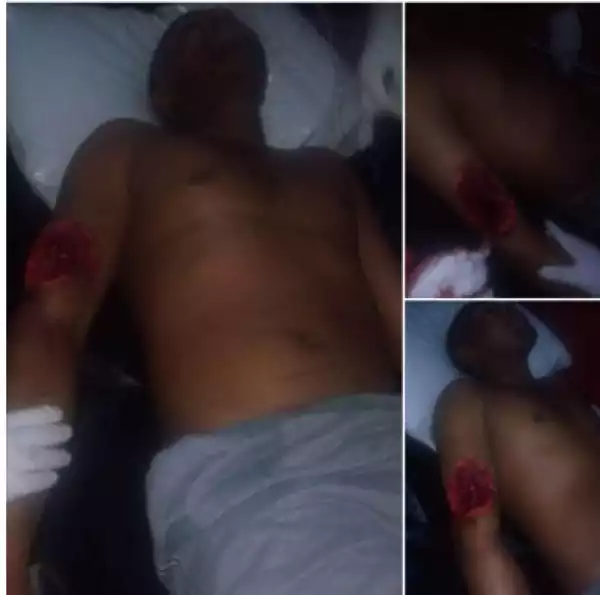 Man Stabs Neighbor With Broken Bottle Over Foiled Attempt To Attack His Wife (Photos Viewer Description)
